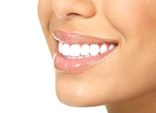 Blanqueamiento dental